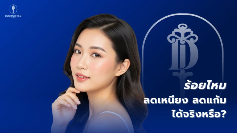 ร้อยไหม_ลดเหนียง ลดแก้ม ได้จริงหรือ